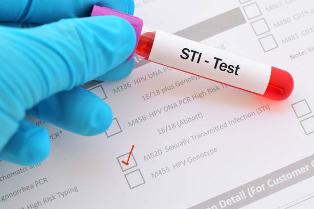 STD Testing at Home